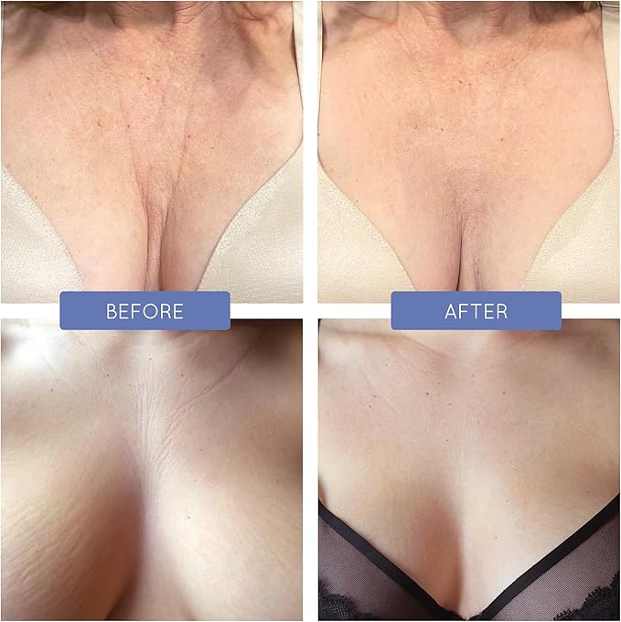 Soobi Satin Breast Pillow Bra: C+ Cup Breast Support for Chest Wrinkles, Side Sleeping, Wrinkle Prevention & Post-Op Recovery
